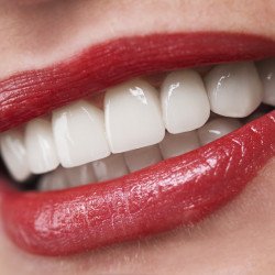 Delray Beach Dental Implants